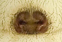 Cheiracanthium mildei