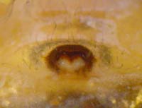Zygiella atrica